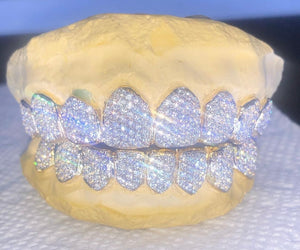 VVS1 Moissanite Or VS1 Lab Diamond Grill